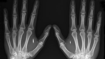 RFID Implants_doomsday_604x341